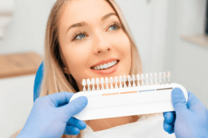 Am I a Good Fit for Veneers? The Checks a Dentist Does First