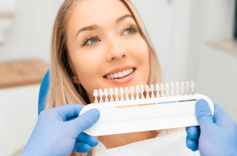 Am I a Good Fit for Veneers? The Checks a Dentist Does First
