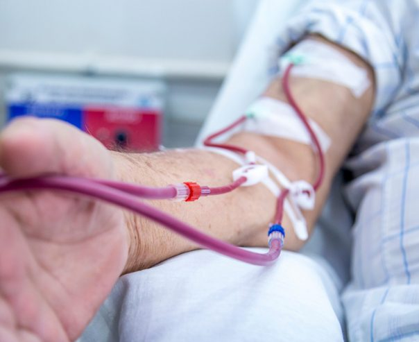 Is In-Home Hemodialysis Possible? What You Need to Know