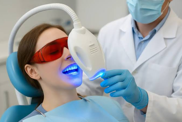 Selective Teeth Whitening: Can One Dental Arch Be Treated Separately?
